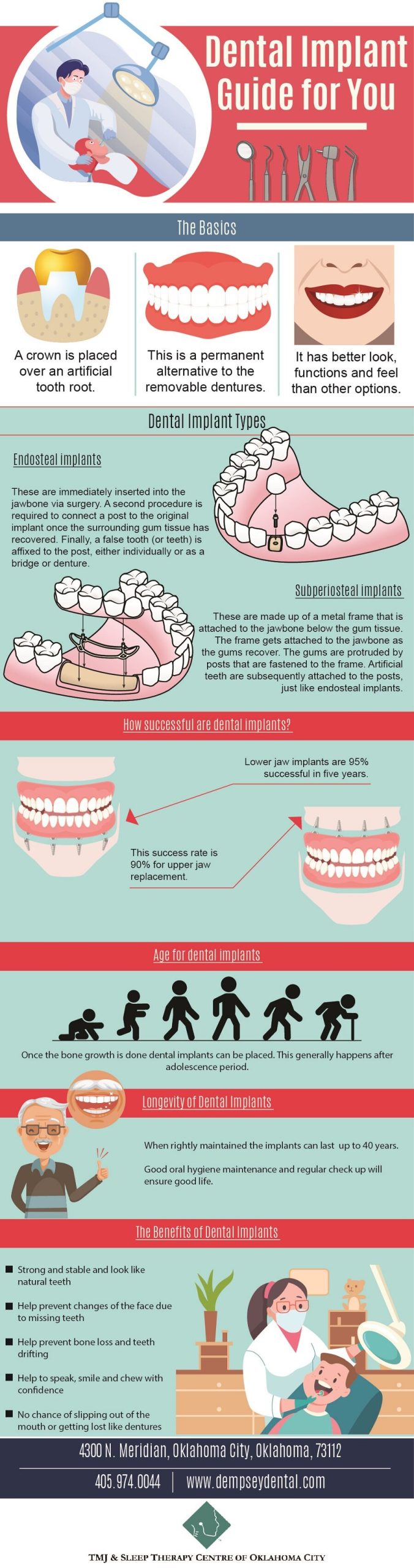 Dental implant guide